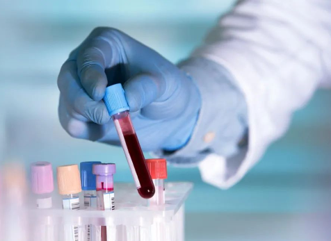 迪諾學(xué)院-IVD大講堂I第二課《試劑項(xiàng)目大分類》